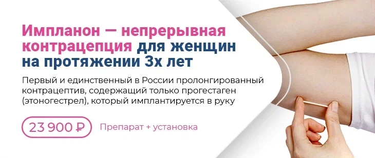Установка контрацептива Импланон® = 23900 рублей